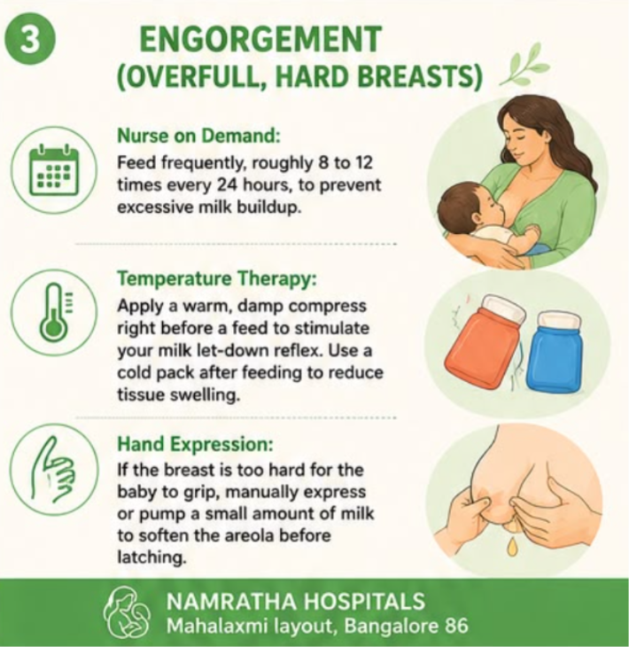 Engorgement Care and Solutions