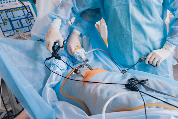 Lapcholecystectomyappendicectomy at Namratha Hospitals