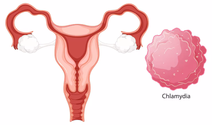 Laparoscopicovariancystectomy at Namratha Hospitals