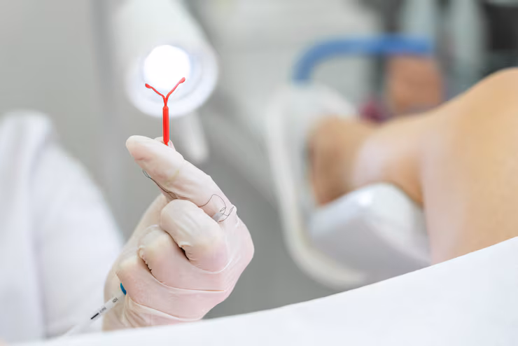 Hysteroscopictubalcannulation at Namratha Hospitals